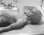 roswell_autopsy1.jpg