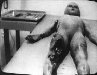 roswell_autopsy4.jpg